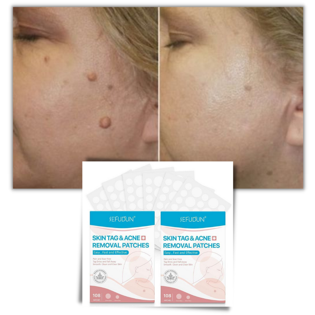 Patch de traitement anti excroissances cutanées - Ozerty