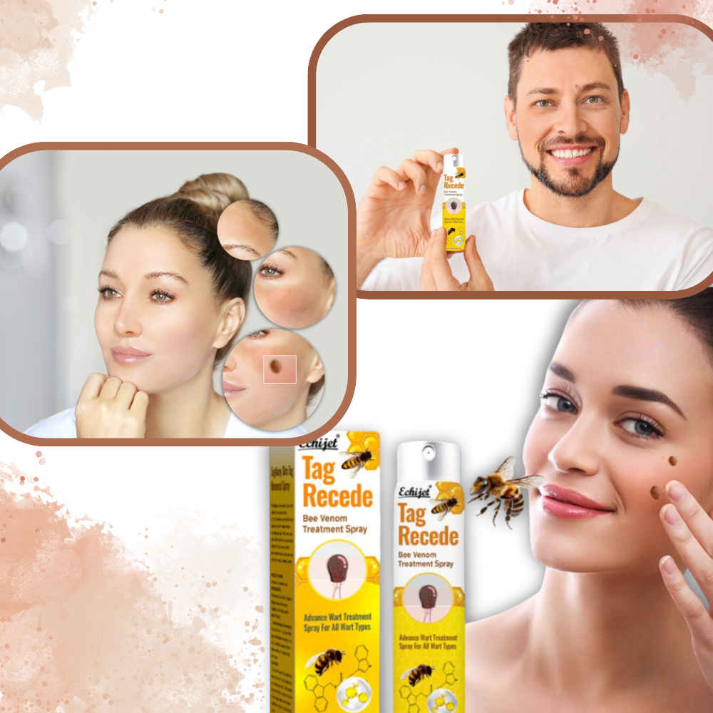 Traitement non invasif des excroissances - Ozerty