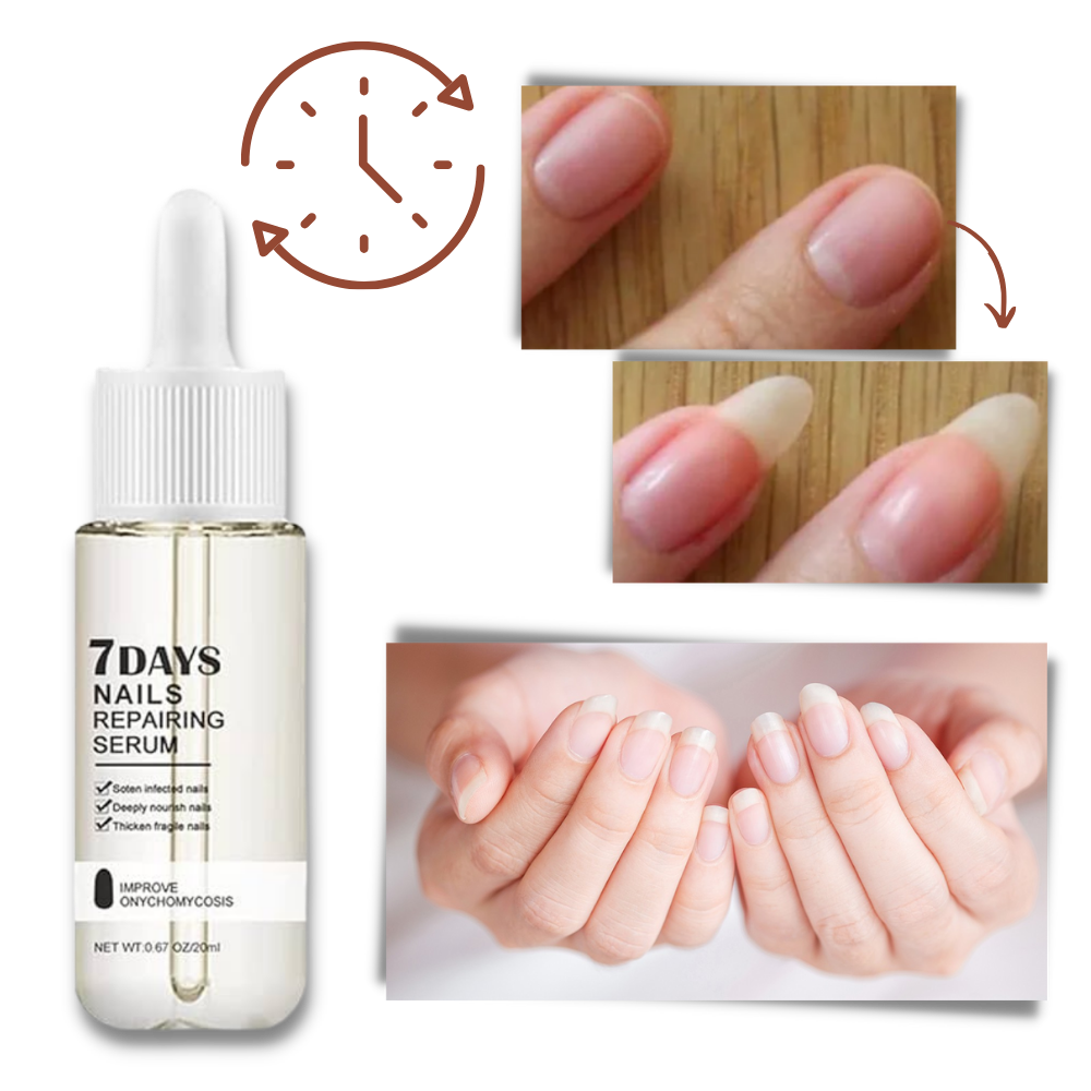 Sérum réparateur pour les ongles en 7 jours - Ouistiprix