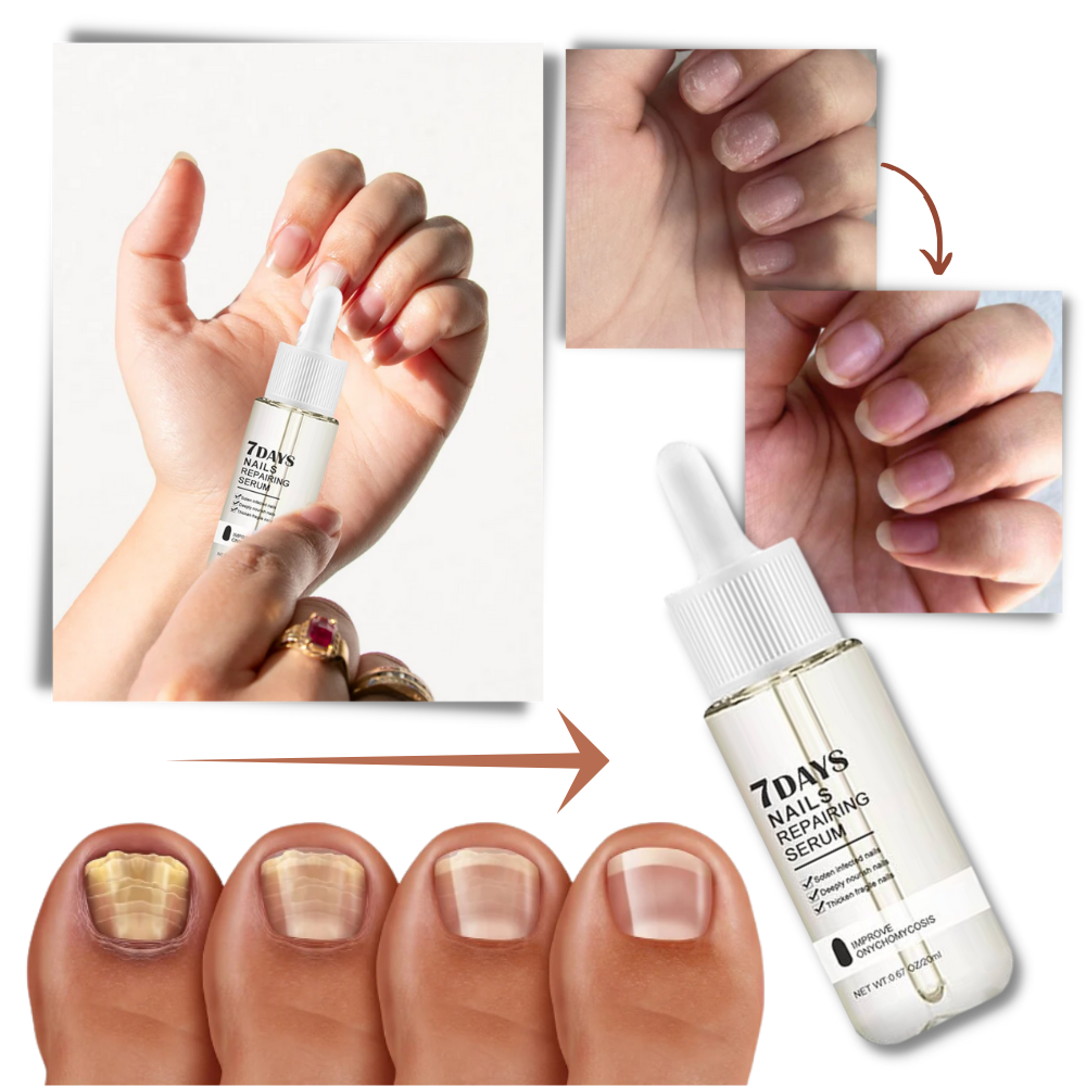 Sérum réparateur pour les ongles en 7 jours - Ouistiprix