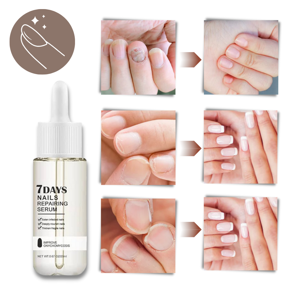 Sérum réparateur pour les ongles en 7 jours - Ouistiprix