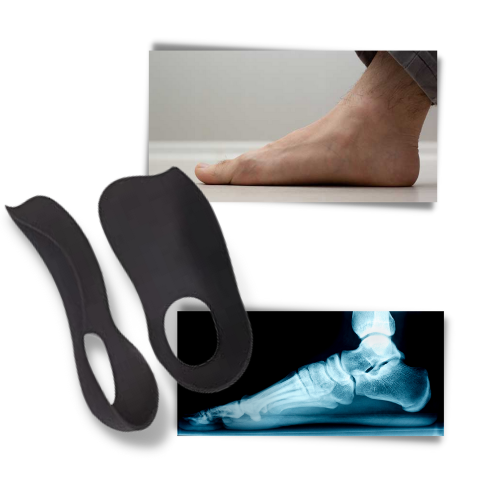 Semelles orthopédiques pour pieds plats - Ouistiprix