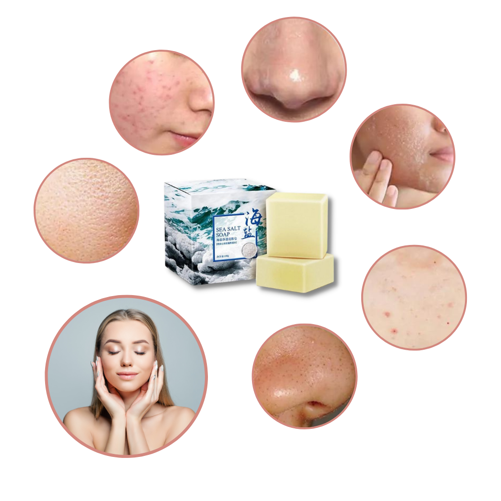 Savon anti acnéique au sel de mer naturel - Ouistiprix