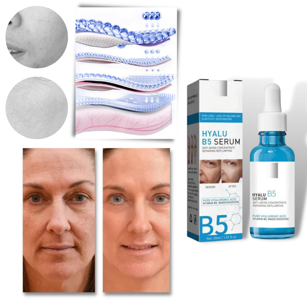 Sérum rajeunissant à l'acide hyaluronique Hyalu B5 - Ouistiprix