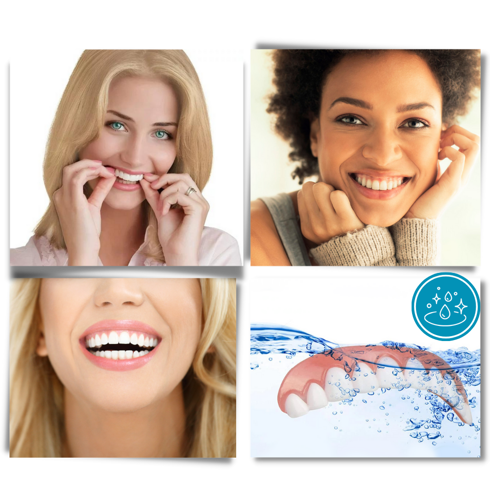 Facettes dentaires à clipser - Ouistiprix