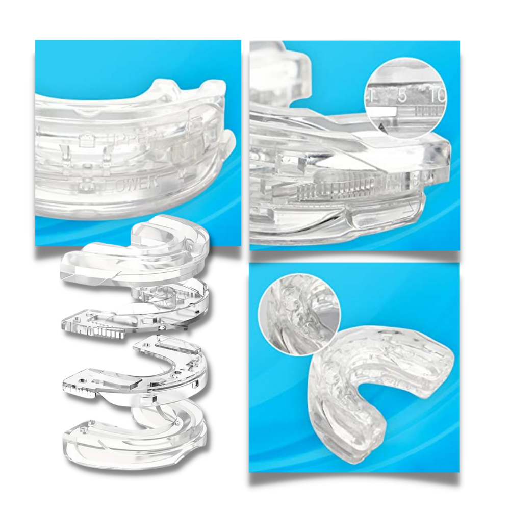 Dispositif avancé anti-ronflement

 - Ozerty